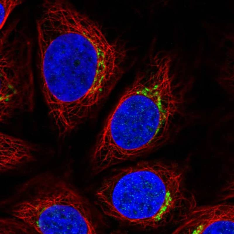 Staining of human cell line SiHa shows localization to the Golgi apparatus.