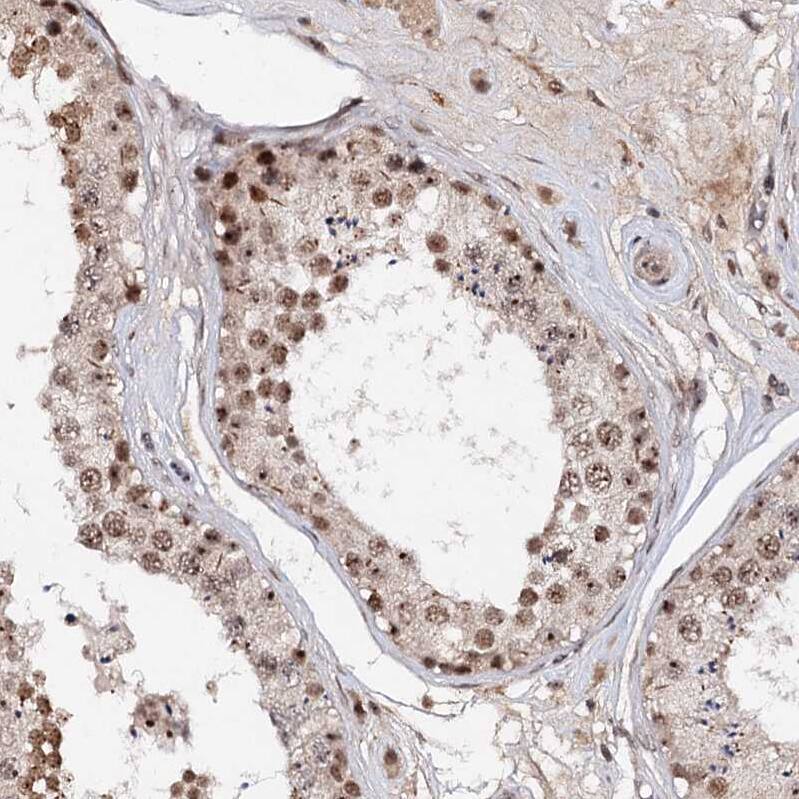 Staining of human testis shows strong nuclear positivity in cells in seminiferous ducts.