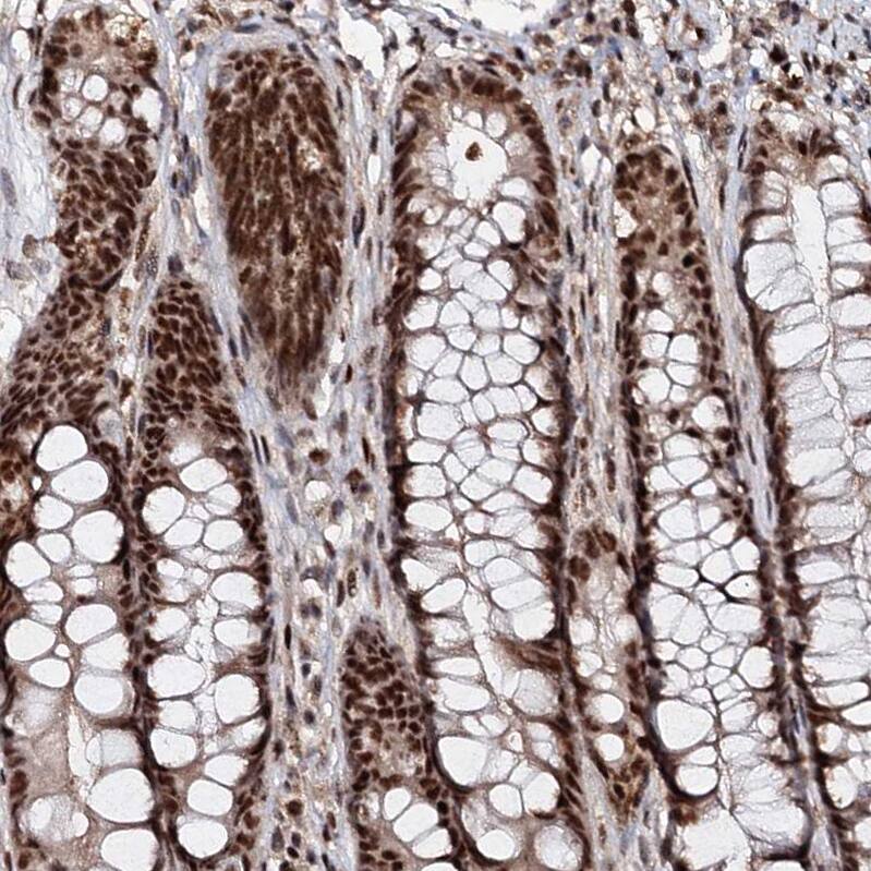 Staining of human rectum shows strong nuclear positivity in glandular cells.