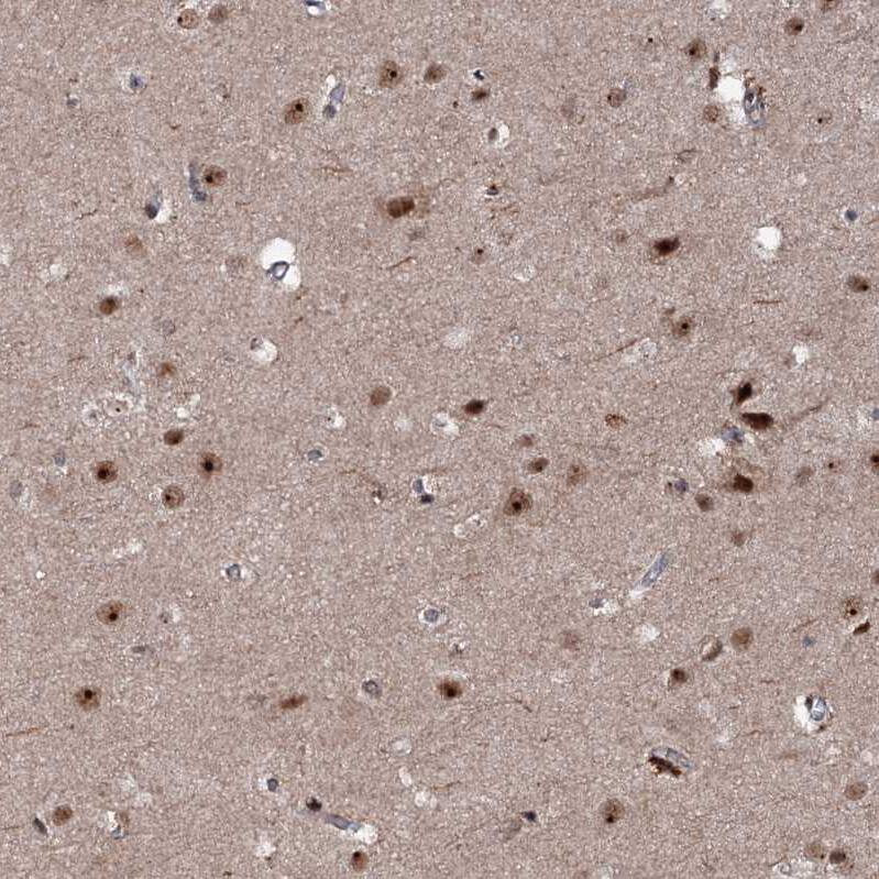 Staining of human cerebral cortex shows strong nuclear positivity in neurons.