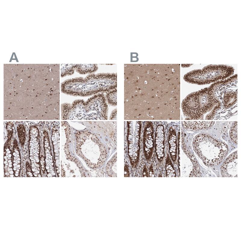 Staining of human cerebral cortex, fallopian tube, gastrointestinal and testis HPA038341 (A) shows similar protein distribution across tissues to independent antibody HPA038340 (B).