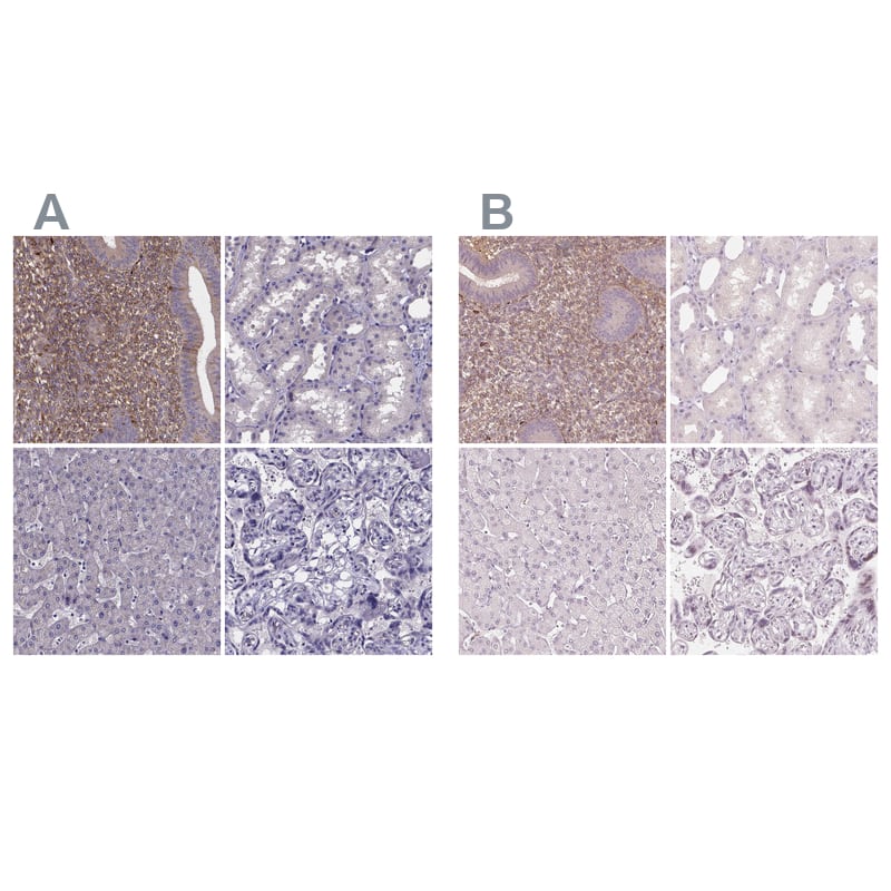 <b>Independent Antibodies Validation. </b>Staining of human endometrium, kidney, liver and placenta using NBP1-81866 (A) shows similar protein distribution across tissues to independent antibody NBP2-38632 (B).