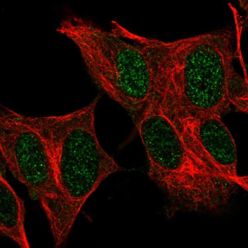 Immunocytochemistry/ Immunofluorescence FOXR2 Antibody - BSA Free