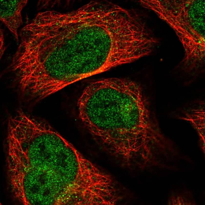Immunocytochemistry/ Immunofluorescence MTFMT Antibody - BSA Free
