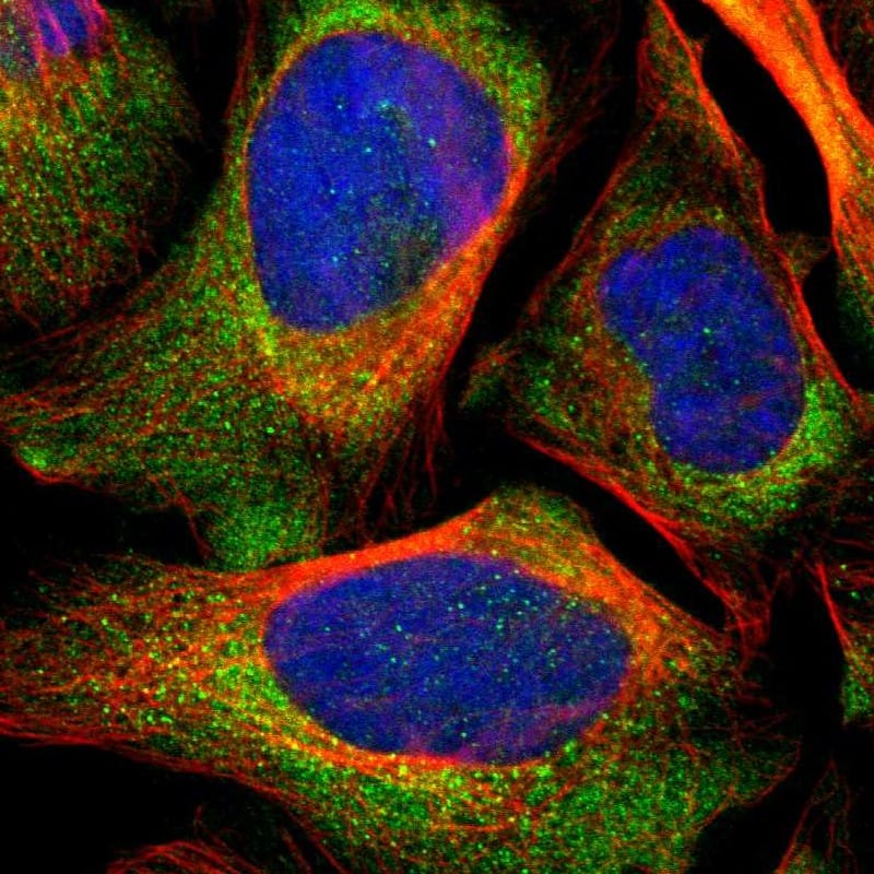 Staining of human cell line U-2 OS shows localization to cytosol.