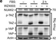 Western Blot: NUAK2 Antibody [NBP1-81880] - NUAK2 activity is involved in serum-induced or LPA-induced YAP/TAZ dephosphorylation & activation. a, b FBS & LPA activate YAP/TAZ & induce NUAK2 expression. YAP/TAZ phosphorylation status was monitored using Phos-Tag gels (a), while NUAK2 & ANKRD1 mRNA expression was determined by qPCR at the indicated times. Expression data are plotted as the mean ± SD (n = 3). c–h WZ4003 (10 μM) blocks serum/LPA-induced NUAK2 & ANKRD1 mRNA expression. FBS-induced or LPA-induced YAP/TAZ dephosphorylation (e & g), or NUAK2 & ANKRD1 mRNA expression (c, f, h) was monitored at the indicated times (d). Expression data are plotted as the mean ± range for a representative experiment (c, f, h) Image collected & cropped by CiteAb from the following publication (//pubmed.ncbi.nlm.nih.gov/30158528), licensed under a CC-BY license. Not internally tested by Novus Biologicals.