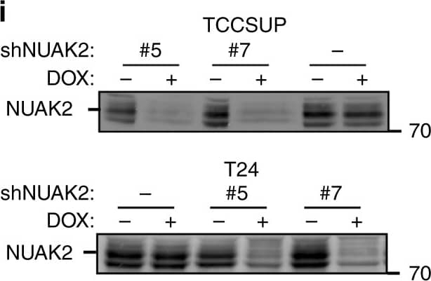 Western Blot: NUAK2 Antibody [NBP1-81880] - NUAK2 is associated with high-grade human bladder cancer. a, c Expression of NUAK2 & the YAP Signature Genes (YAP SG) is enhanced both in high-grade non-muscle-invasive (HG-NMIBC; n = 13, **p = 0.0071) & muscle-invasive (pT2 MIBC; n = 9, **p = 0.0033) bladder cancers39 as compared to LG-NMIBC (n = 27) using an unpaired t test. b Elevated expression of NUAK2 is correlated with disease recurrence in a cohort41 of MIBC patient samples with n = 57 disease free & n = 56, recurred samples (*p = 0.0172). Box & whisker plots show the median (line in the box), first & third quartiles (lower & upper ends of the box), & the minimum & maximum values (whiskers in the plot). Dots represent a single patient sample. d A heat map depicting expression of NUAK2 & YAP SG in NMIBC LG (open circle), HG (closed circle), & MIBC pT2 (slashed circle) bladder cancer samples39. e Characterization of high-grade-derived & low-grade-derived bladder cancer cell lines. Scale bar, 25 μm. f NUAK2 mRNA expression is elevated in HG-derived (TCCSUP & T24) BC cell lines as compared to LG lines. Data are plotted as the mean ± SD (n = 3). g–i Blocking NUAK2 activity with 10 μM WZ4003 (g) or NUAK2 expression in stable clones (#5 or #7) using inducible NUAK2 shRNAs (h, i) inhibits the growth of HG BC cell lines as measured by SRB (g) or DAPI (h) staining. Data are plotted as the mean ± SD of a representative experiment, n = 3 (for TCC) or mean ± range of two experiments (for T24) Image collected & cropped by CiteAb from the following publication (//pubmed.ncbi.nlm.nih.gov/30158528), licensed under a CC-BY license. Not internally tested by Novus Biologicals.