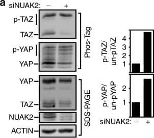 Western Blot: NUAK2 Antibody [NBP1-81880] - NUAK2 regulates YAP/TAZ activity through LATS. a Loss of NUAK2 enhances YAP/TAZ phosphorylation in MDA-MB231 cells. Quantitation of relative phosphorylation levels from blots is shown. b NUAK2 interacts with LATS1 & LATS2, but not MST1, MST2, or TAZ in the LUMIER protein interaction screen. c Lysates from HEK293T cells, transfected with NUAK2-Flag, were subjected to immunoprecipitation (IP) using anti-LATS1 antibody for endogenous LATS1 & co-immunoprecipitated NUAK2-Flag was detected by immunoblotting. Protein expression levels were confirmed (Totals). WT wild type, KR K81R, kinase dead. d–f NUAK2 requires LATS to regulate YAP/TAZ localization, phosphorylation, & target gene expression in MDA-MB231 cells. d YAP/TAZ localization was quantitated & plotted as the mean ± SD (n = 3) with representative images shown on the right. Scale bars, 25 μm. N: nuclear, C: cytoplasmic. e Target gene expression was determined by qPCR. Data are plotted as the mean ± SD (n = 3). f YAP/TAZ phosphorylation was monitored using Phos-Tag gels. Relative phosphorylation levels from blots is quantitated (right) Image collected & cropped by CiteAb from the following publication (//pubmed.ncbi.nlm.nih.gov/30158528), licensed under a CC-BY license. Not internally tested by Novus Biologicals.