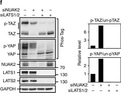 Western Blot: NUAK2 Antibody [NBP1-81880] - NUAK2 regulates YAP/TAZ activity through LATS. a Loss of NUAK2 enhances YAP/TAZ phosphorylation in MDA-MB231 cells. Quantitation of relative phosphorylation levels from blots is shown. b NUAK2 interacts with LATS1 & LATS2, but not MST1, MST2, or TAZ in the LUMIER protein interaction screen. c Lysates from HEK293T cells, transfected with NUAK2-Flag, were subjected to immunoprecipitation (IP) using anti-LATS1 antibody for endogenous LATS1 & co-immunoprecipitated NUAK2-Flag was detected by immunoblotting. Protein expression levels were confirmed (Totals). WT wild type, KR K81R, kinase dead. d–f NUAK2 requires LATS to regulate YAP/TAZ localization, phosphorylation, & target gene expression in MDA-MB231 cells. d YAP/TAZ localization was quantitated & plotted as the mean ± SD (n = 3) with representative images shown on the right. Scale bars, 25 μm. N: nuclear, C: cytoplasmic. e Target gene expression was determined by qPCR. Data are plotted as the mean ± SD (n = 3). f YAP/TAZ phosphorylation was monitored using Phos-Tag gels. Relative phosphorylation levels from blots is quantitated (right) Image collected & cropped by CiteAb from the following publication (//pubmed.ncbi.nlm.nih.gov/30158528), licensed under a CC-BY license. Not internally tested by Novus Biologicals.