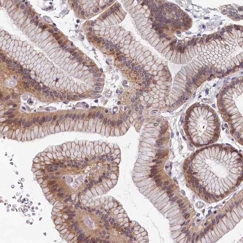 Staining of human stomach shows moderate membranous positivity in glandular cells.