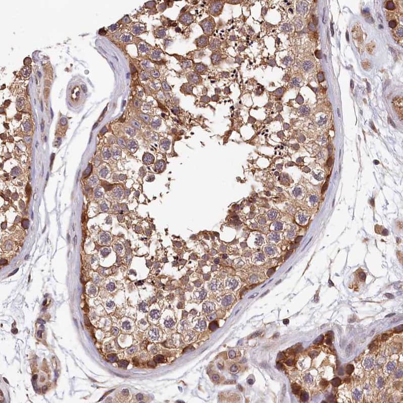 Staining of human testis shows moderate membranous positivity in cells in seminiferous ducts.