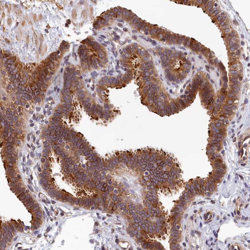 Staining of human fallopian tube shows strong membranous positivity in glandular cells.