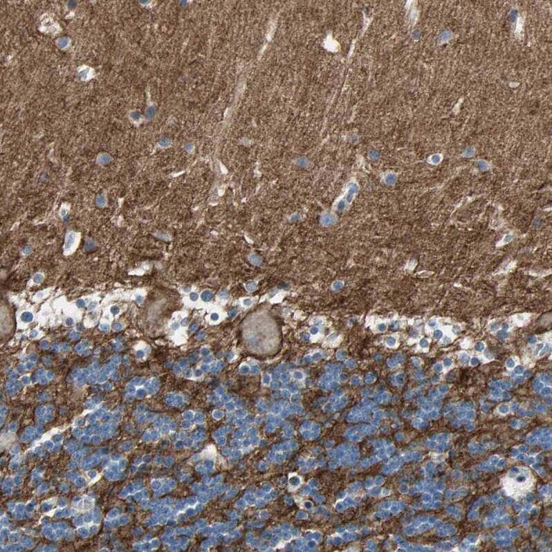 Staining of human cerebellum shows strong positivity in neuronal processes.