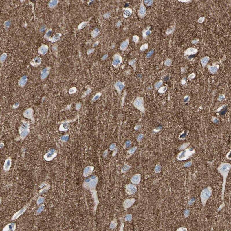Staining of human cerebral cortex shows strong positivity in neuropil.