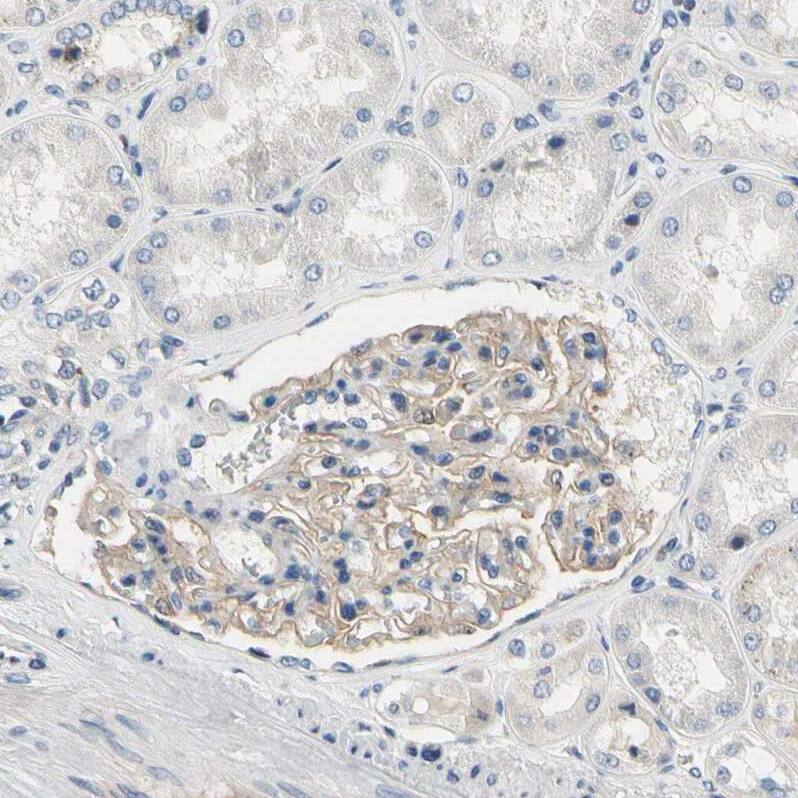 Staining of human kidney shows moderate membranous positivity in cells in glomeruli.