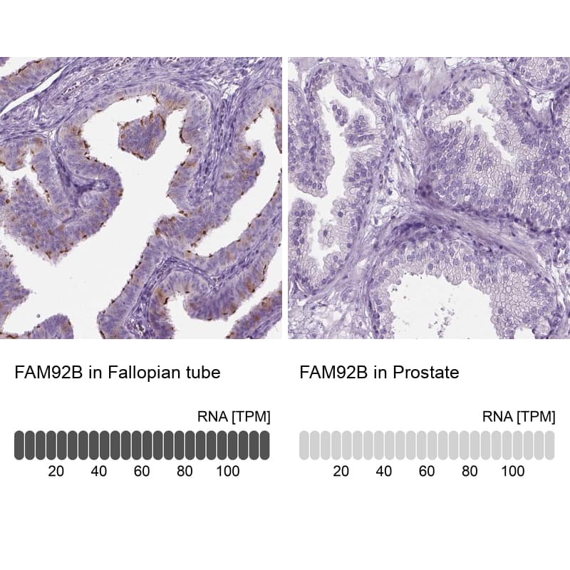 <b>Orthogonal Strategies Validation. </b>Analysis in human fallopian tube and prostate tissues.