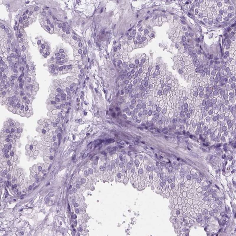 Staining of human prostate shows low expression as expected.