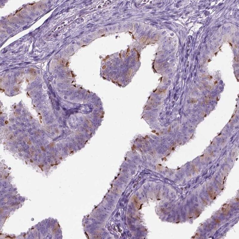 Staining of human fallopian tube shows high expression.