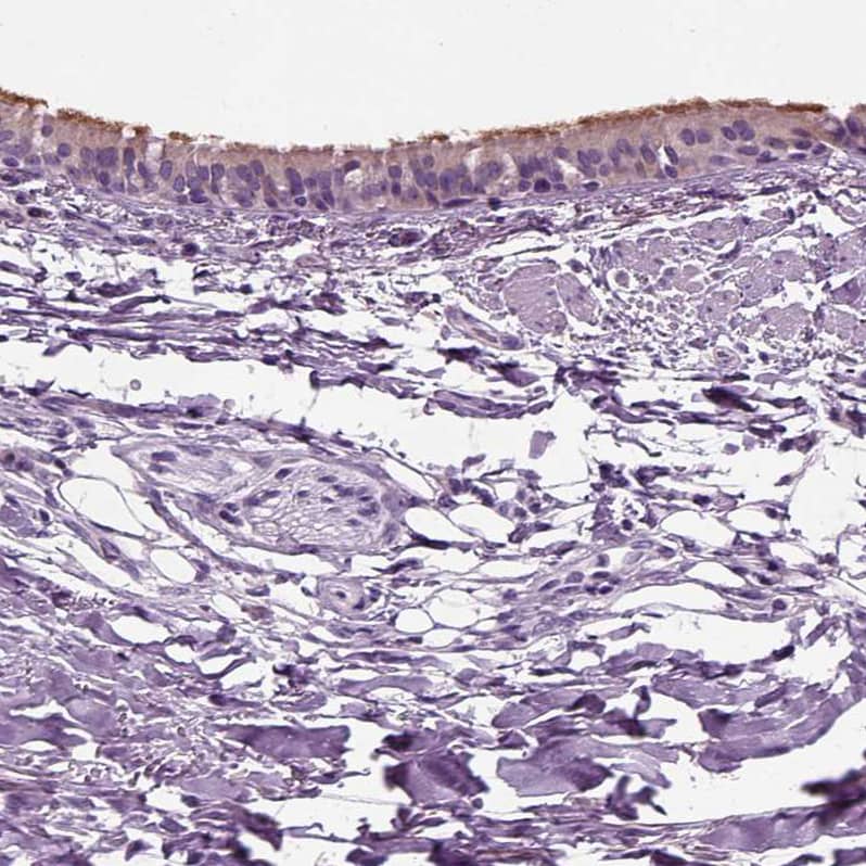 Immunohistochemistry-Paraffin DNAH10 Antibody - BSA Free