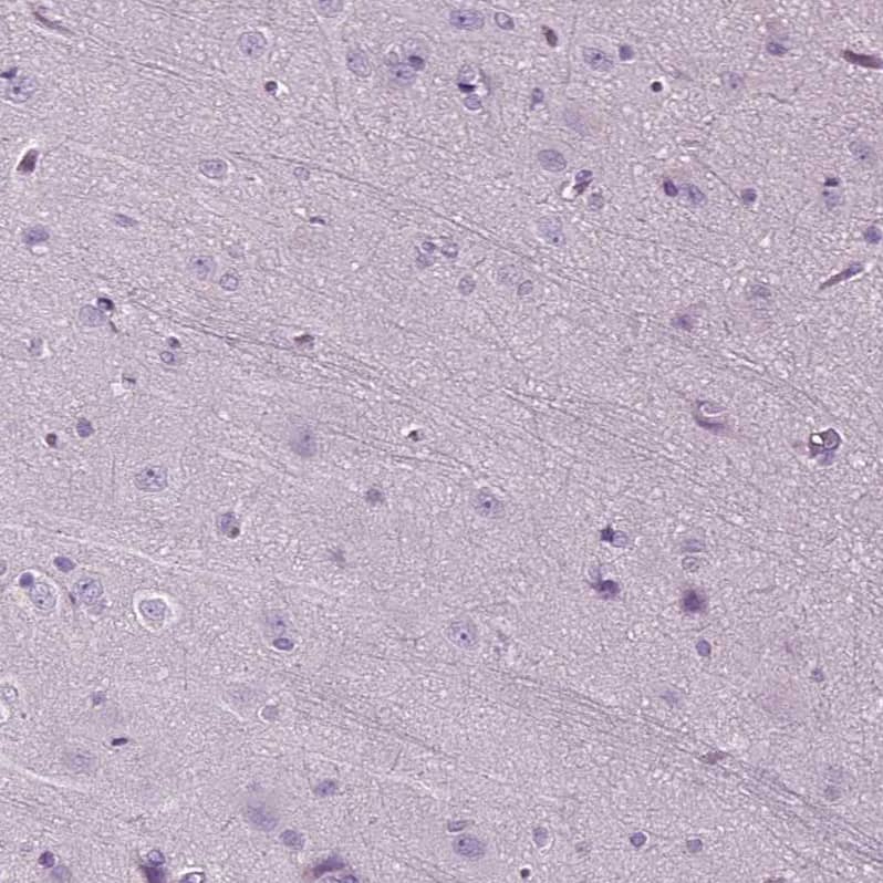 Immunohistochemistry-Paraffin DNAH10 Antibody - BSA Free