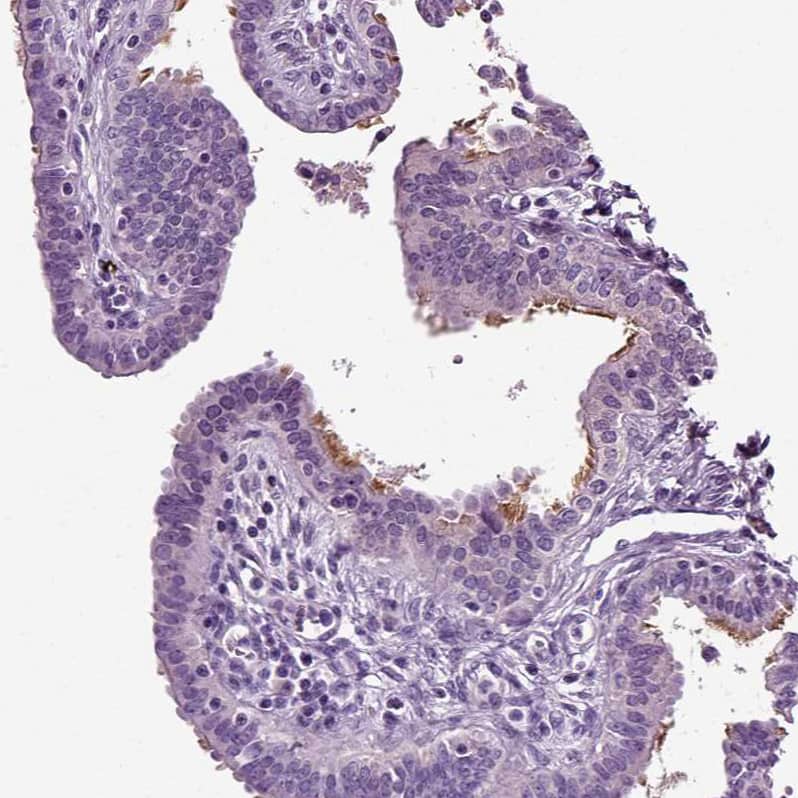 Immunohistochemistry-Paraffin DNAH10 Antibody - BSA Free