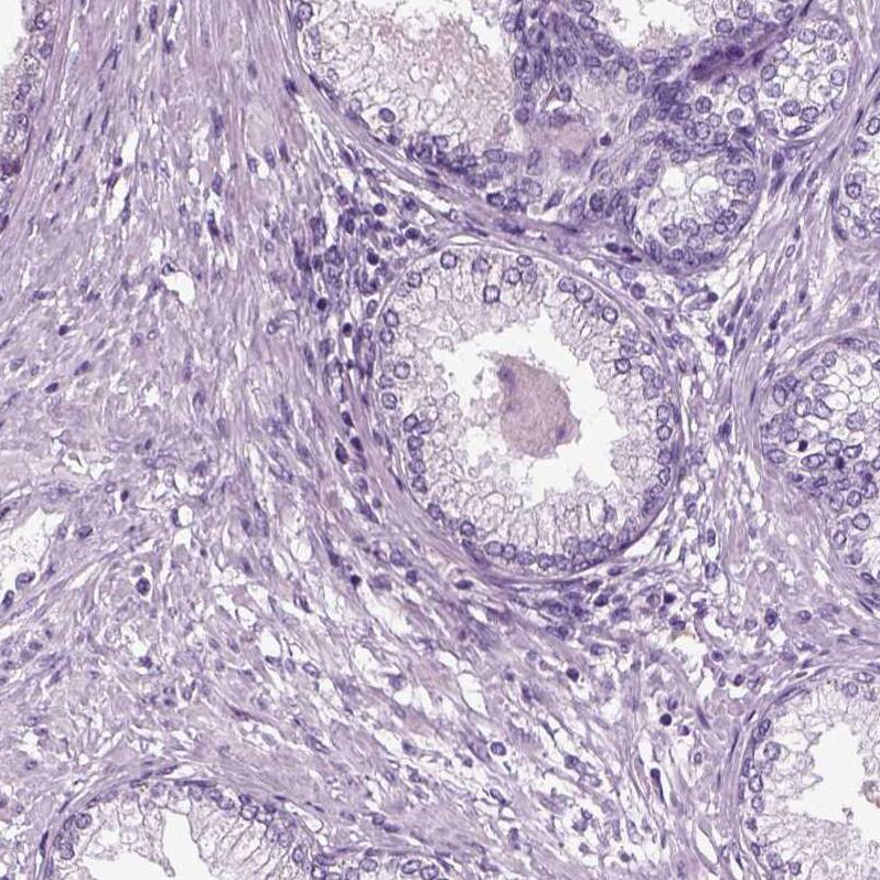 Staining of human prostate shows no positivity in glandular cells.