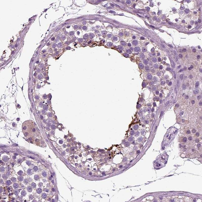 Staining of human testis shows weak to moderate positivity in cilia in spermatids.
