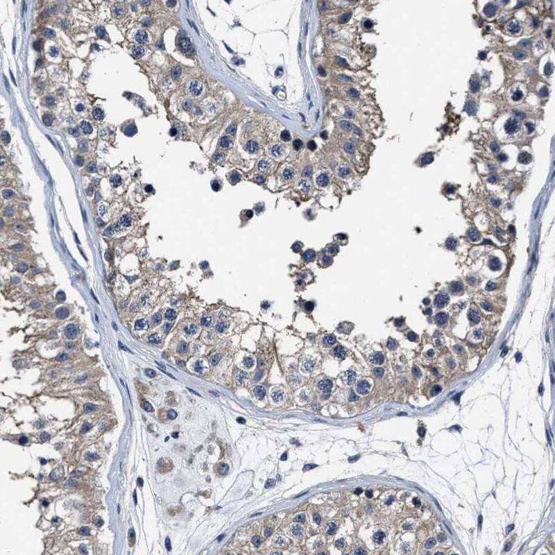 Staining of human testis shows cytoplasmic positivity in cells in seminiferous ducts.
