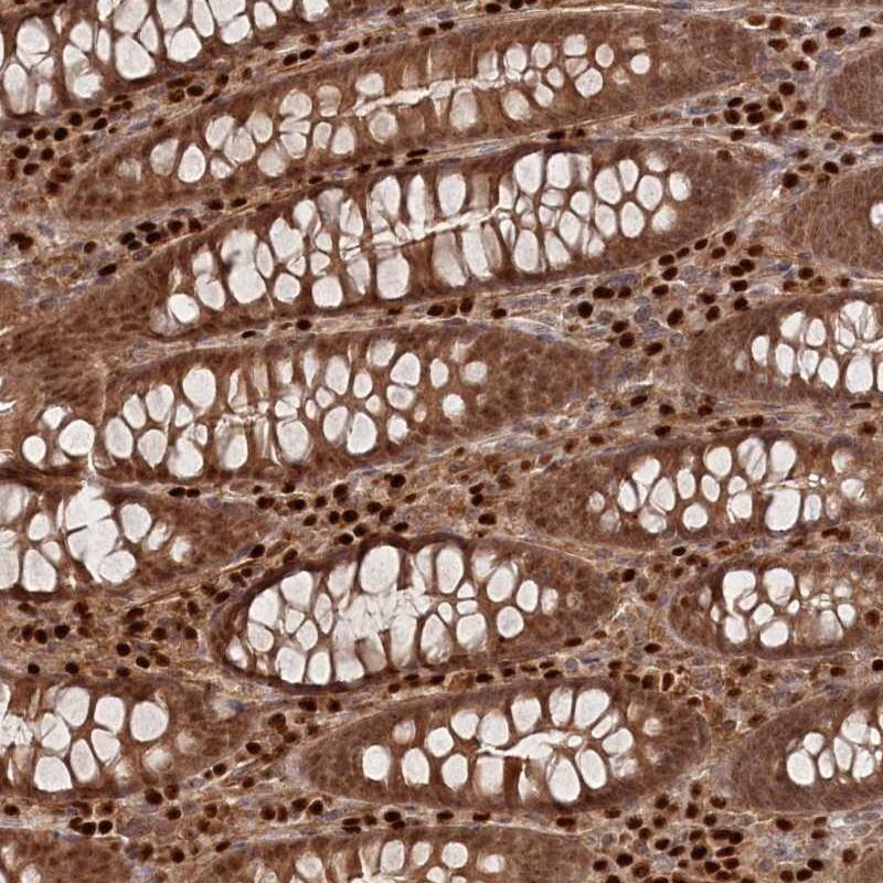 Staining of human colon shows moderate cytoplasmic and nuclear positivity in glandular cells.