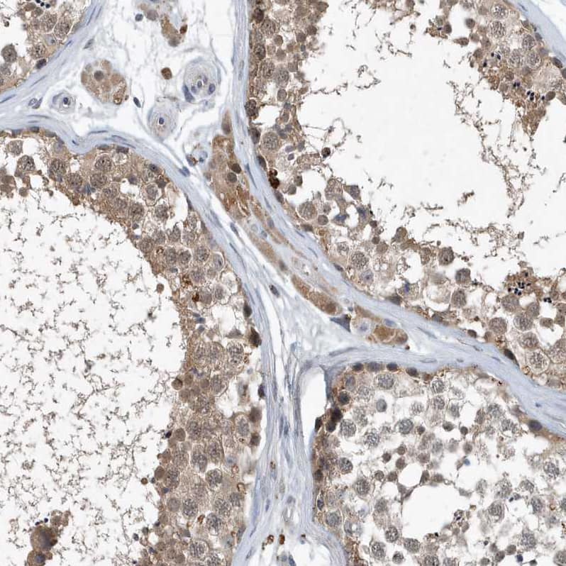 Immunohistochemistry-Paraffin SCFD2 Antibody - BSA Free