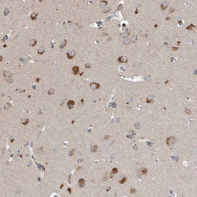 Immunohistochemistry-Paraffin SCFD2 Antibody - BSA Free