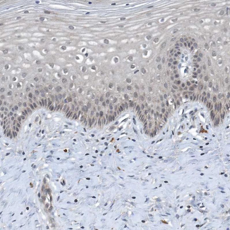 Staining of human cervix, uterine shows weak cytoplasmic positivity in squamous epithelial cells.
