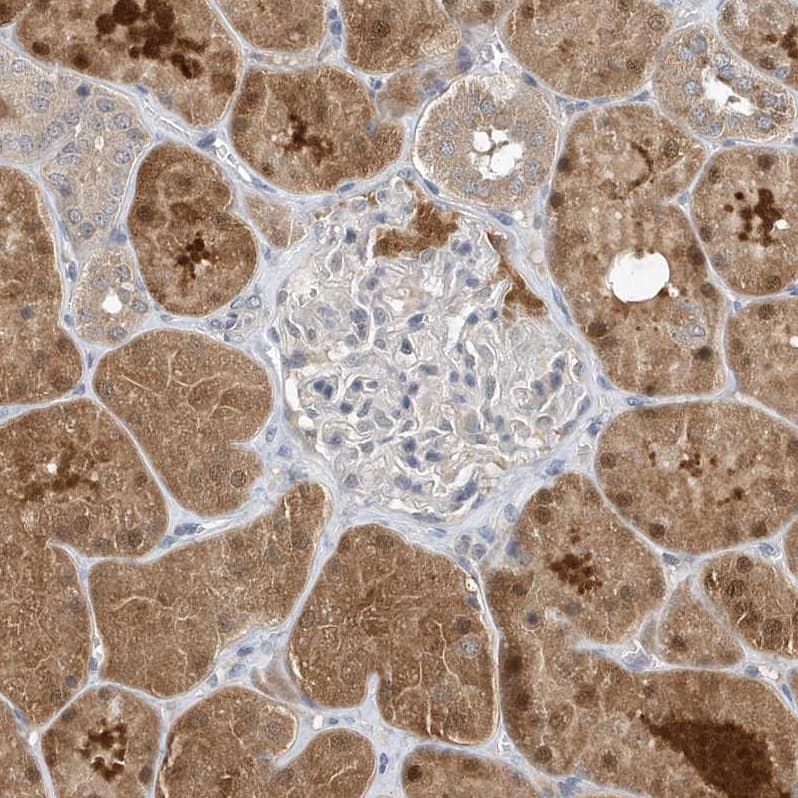 Staining of human kidney shows moderate to strong cytoplasmic positivity in cells in tubules.