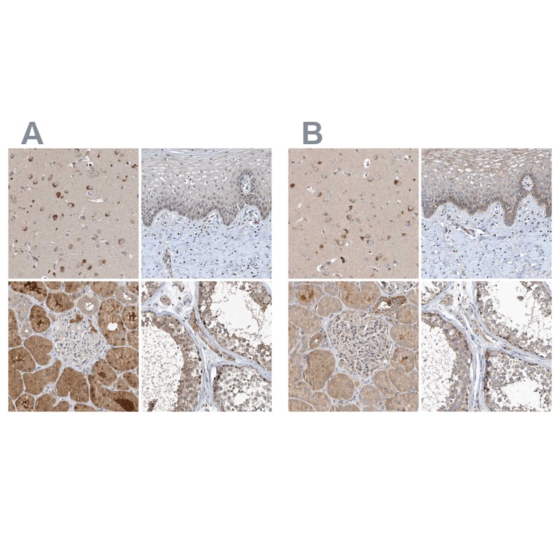 Staining of human cerebral cortex, cervix, uterine, kidney and testis HPA036526 (A) shows similar protein distribution across tissues to independent antibody HPA036527 (B).