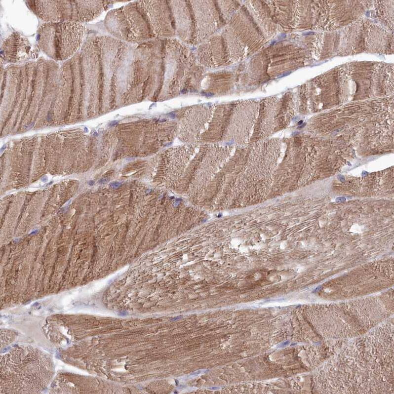Staining of human skeletal muscle shows moderate cytoplasmic positivity in myocytes.