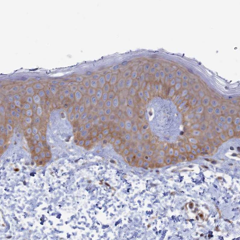 Staining of human skin shows weak cytoplasmic positivity in squamous epithelial cells.