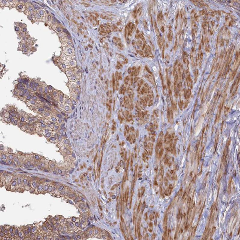 Staining of human prostate shows moderate cytoplasmic positivity in smooth muscle cells and weak membranous staining of glandular cells.