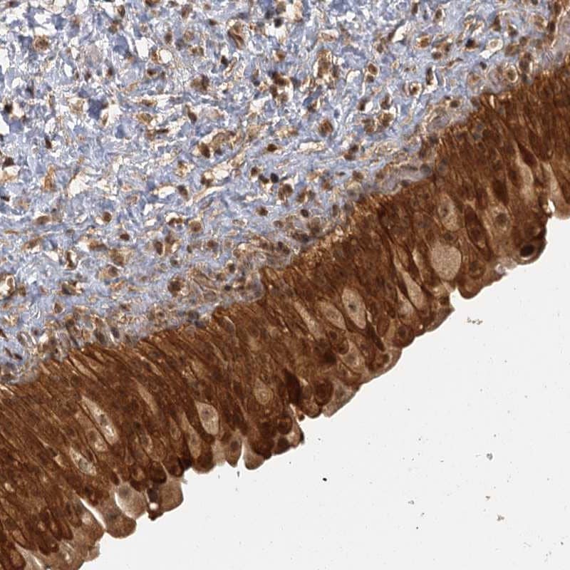 Immunohistochemistry-Paraffin ZNF549 Antibody - BSA Free