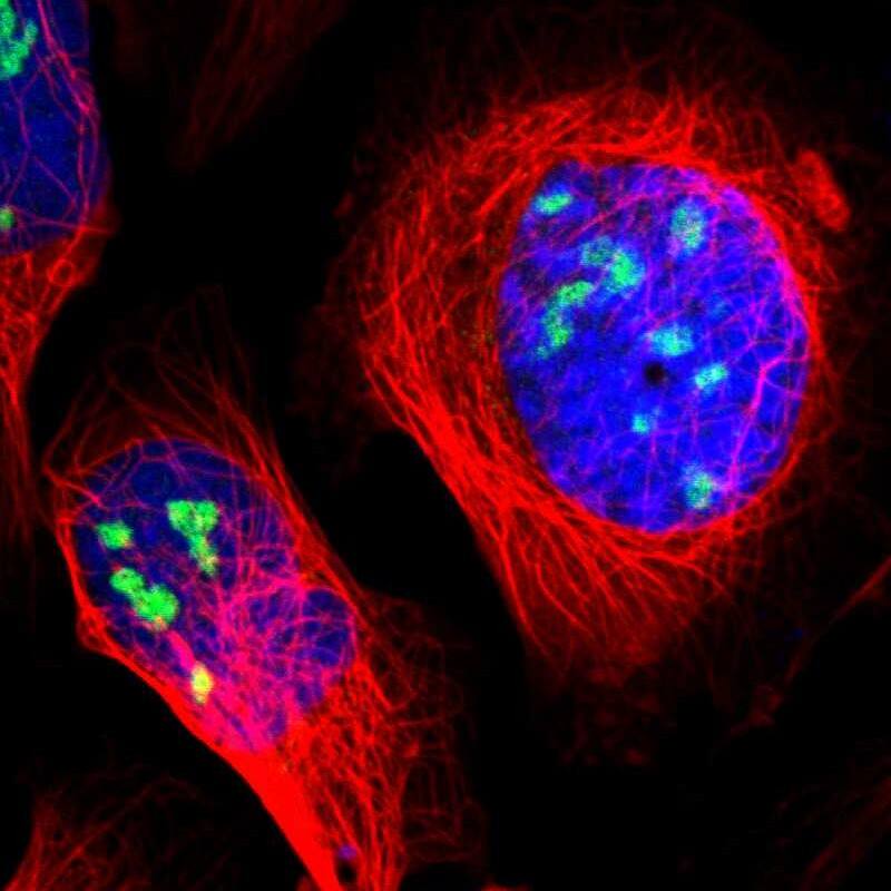 Immunocytochemistry/ Immunofluorescence ZSCAN1 Antibody - BSA Free