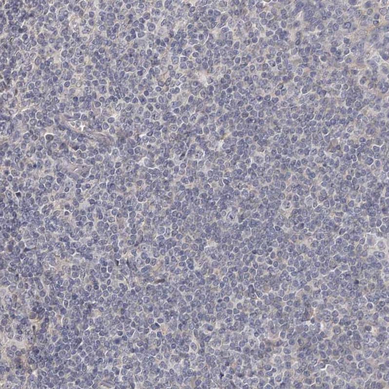 Immunohistochemistry-Paraffin HINT3 Antibody - BSA Free