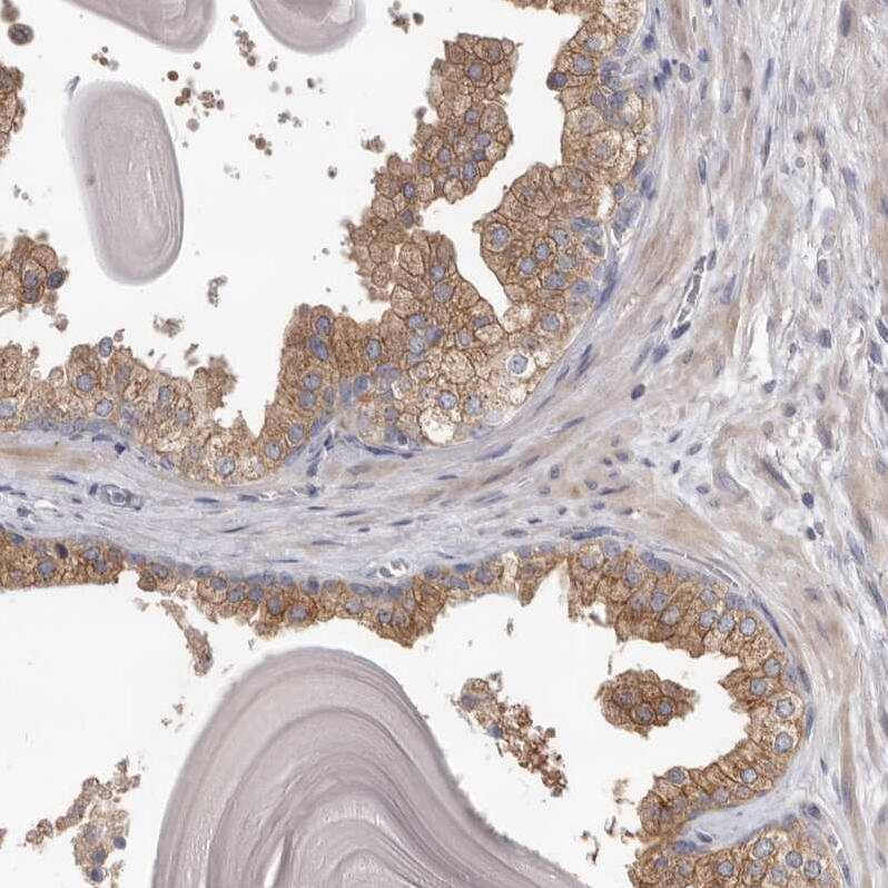 Staining of human prostate shows moderate cytoplasmic positivity in glandular cells.