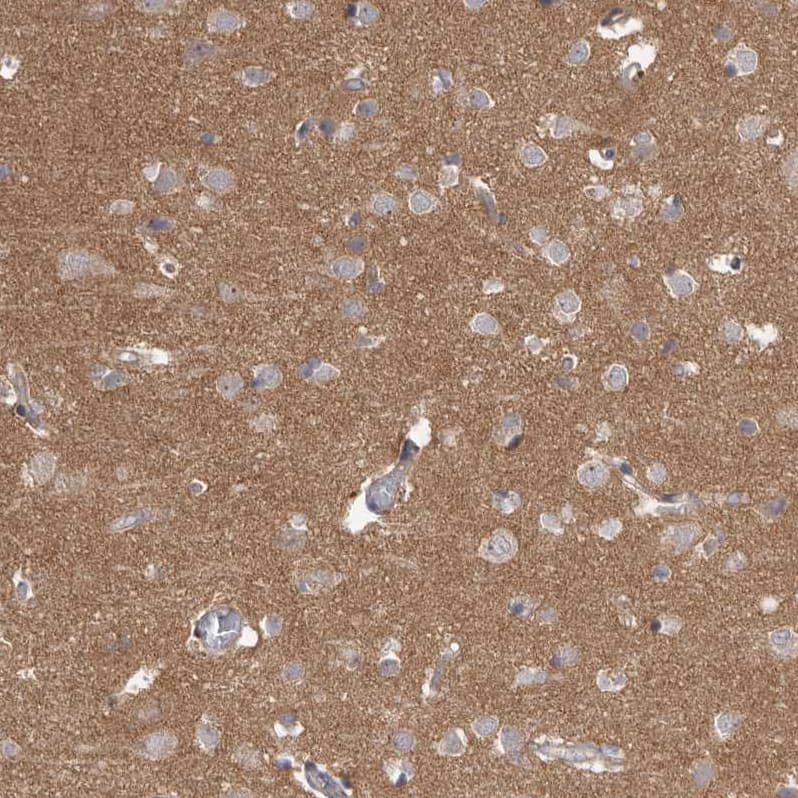 Staining of human cerebral cortex shows moderate cytoplasmic positivity in neurons.