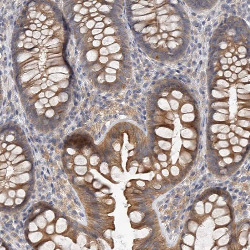 Staining of human colon shows moderate cytoplasmic positivity in glandular cells.