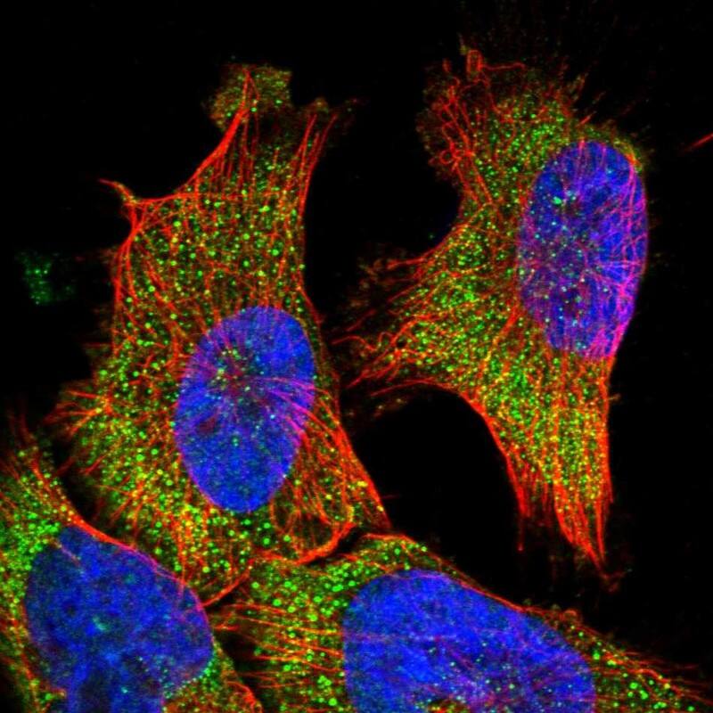 Staining of human cell line U-251 MG shows localization to vesicles.