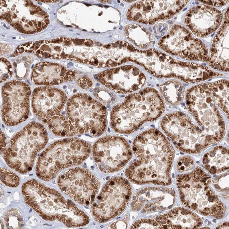 Staining of human kidney shows strong cytoplasmic and nuclear positivity in renal tubules.
