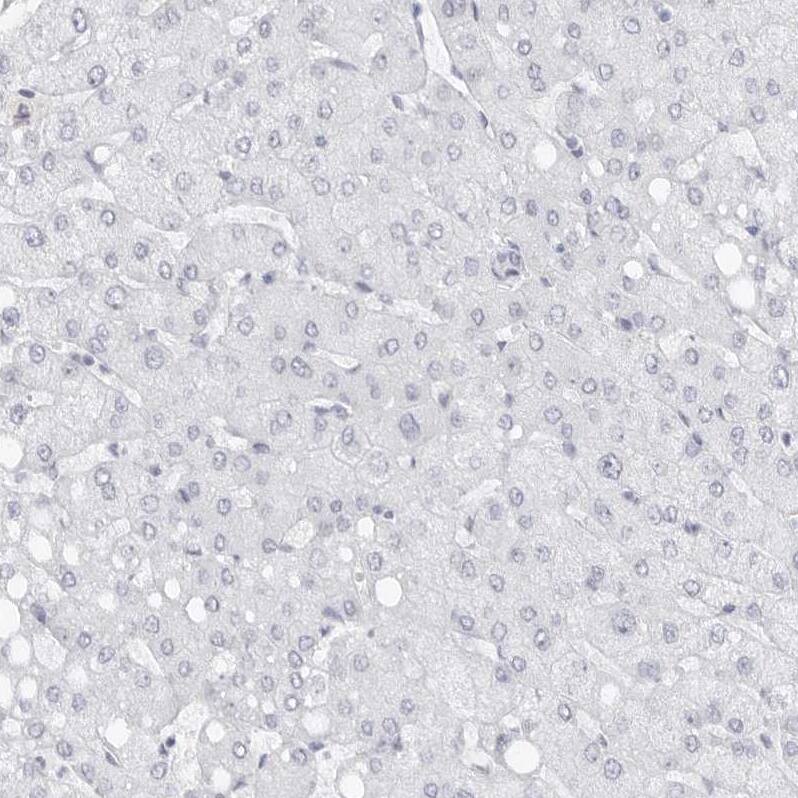 Staining of human liver shows no positivity in hepatocytes as expected.