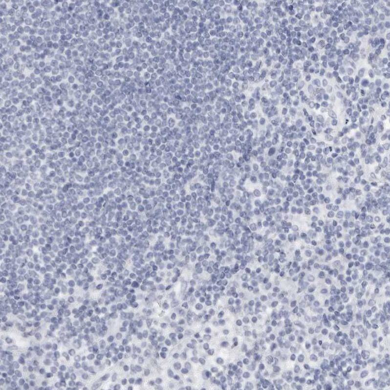 Staining of human lymph node shows no positivity in lymphoid cells as expected.