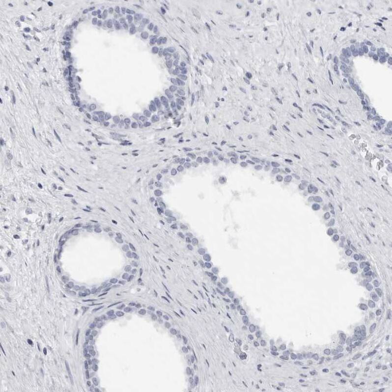 Staining of human prostate shows no positivity in glandular cells as expected.