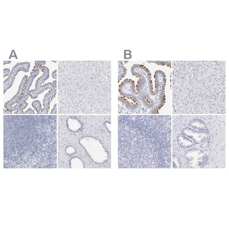 <b>Orthogonal Strategies Validation. </b>Staining of human fallopian tube, liver, lymph node and prostate HPA028623 (A) shows similar protein distribution across tissues to independent antibody HPA002736 (B).