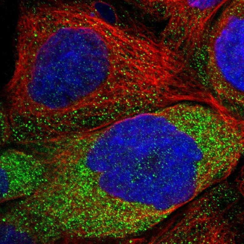 Staining of human cell line A-431 shows localization to cytosol.